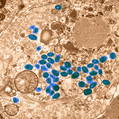 A microscope image of a cell, mainly light brown colours, with around 50 blue-teal spots mainly in the centre and right of the image, and taking up around 20% of the image